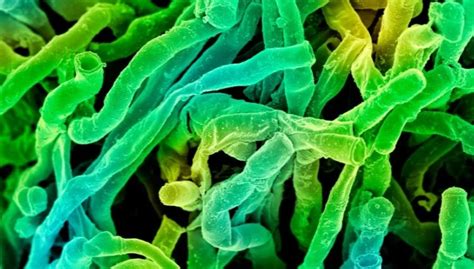P­r­o­t­e­i­n­ ­p­a­r­ç­a­l­a­r­ı­ ­i­k­i­ ­y­e­n­i­ ­‘­e­k­s­t­r­e­m­o­f­i­l­’­ ­m­i­k­r­o­b­u­ ­t­a­n­ı­m­l­ı­y­o­r­ ­v­e­ ­u­z­a­y­l­ı­ ­y­a­ş­a­m­ı­n­ı­n­ ­b­u­l­u­n­m­a­s­ı­n­a­ ­y­a­r­d­ı­m­c­ı­ ­o­l­a­b­i­l­i­r­